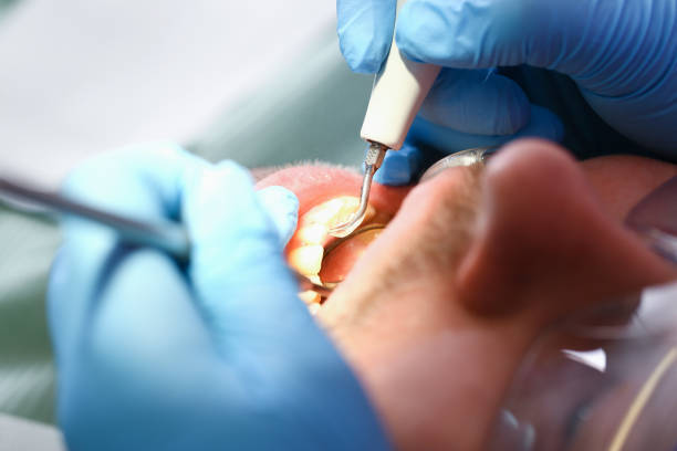 Best Emergency Denture Repair in Strawberry, CA